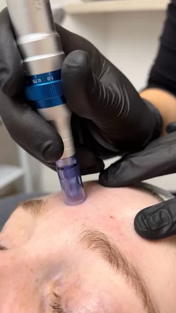 Lifting Lymphatic Drainage