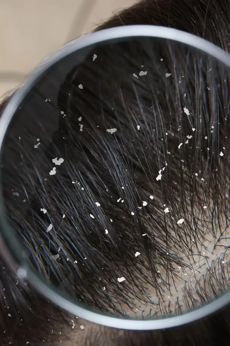 Lifting Lymphatic Drainage