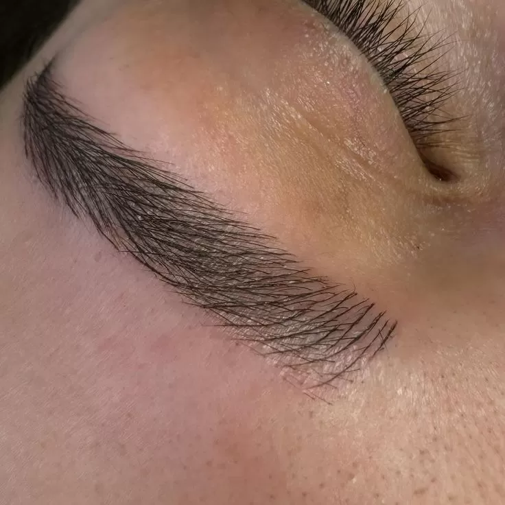 Lifting Lymphatic Drainage