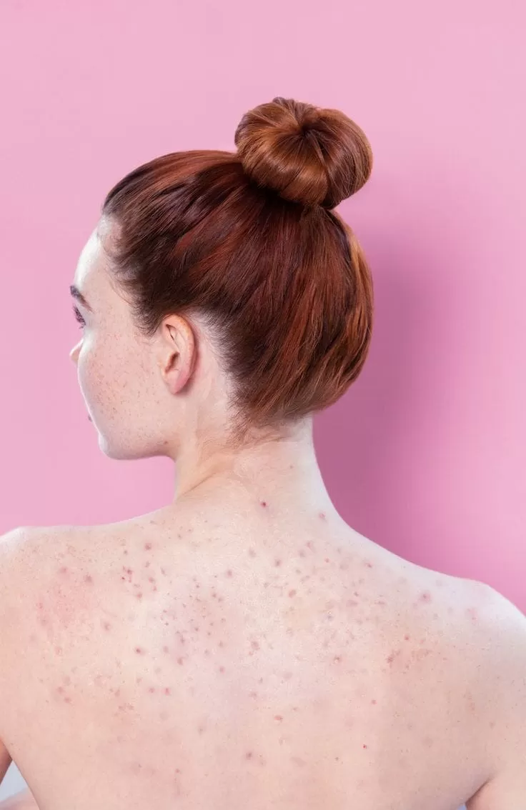 Lifting Lymphatic Drainage